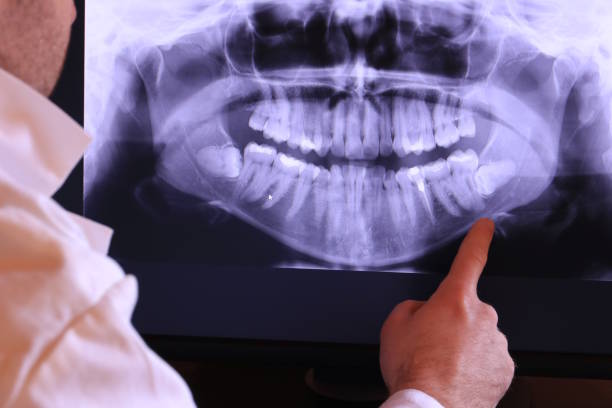 Best Broken or Cracked Tooth Emergency Dentist in Farley, IA